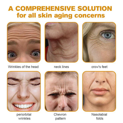 👨‍⚕️ Hergestellt und versendet in den DE ✅ Botox-Bienengift-Faltenentfernungscreme – LETZTER TAG 80 % RABATT