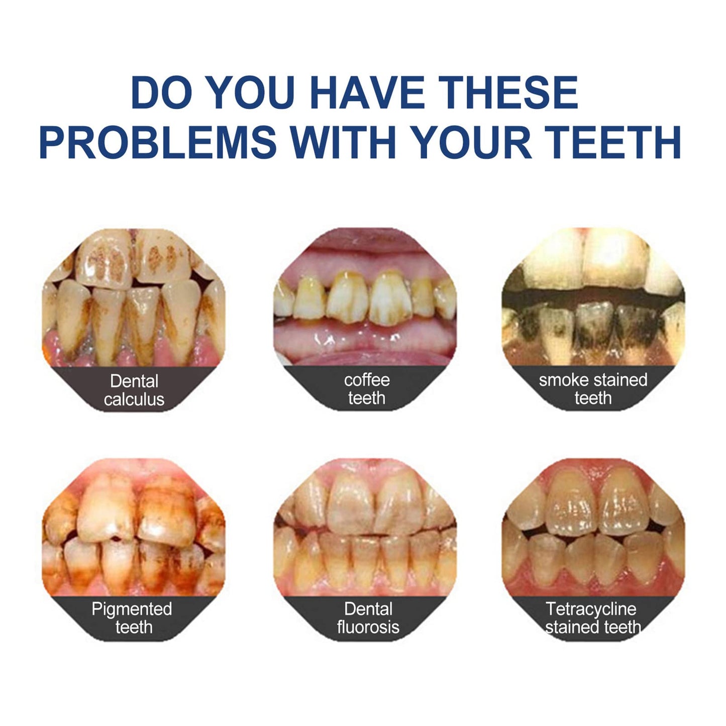 🔥Ends Tonight: Get 60% OFF Before It’s Gone!🎁 BBOJI™ Fluoride-Free Hydroxyapatite Toothpaste – Gentle Whitening & Enamel Strength for Sensitive Teeth