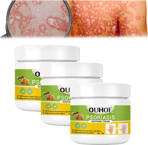 Todahof Bienengift-Psoriasis-Behandlungscreme, Todahof Bienengift-Psoriasis-Behandlungscreme, Todahof Bienengift-Creme, Psoriasis-Creme, Bienengift-Psoriasis-Behandlungscreme (3 Stück)