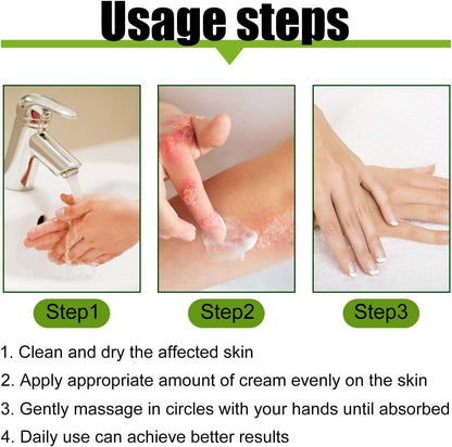 Todahof Bienengift-Psoriasis-Behandlungscreme, Todahof Bienengift-Psoriasis-Behandlungscreme, Todahof Bienengift-Creme, Psoriasis-Creme, Bienengift-Psoriasis-Behandlungscreme (3 Stück)