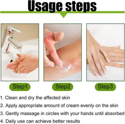 Todahof Bienengift Psoriasis Behandlungscreme, Todahof Bienengift Psoriasis Behandlungscreme, Todahof Bienengift Creme, Psoriasis Creme, Bienengift Psoriasis Behandlungscreme (3 Stück)