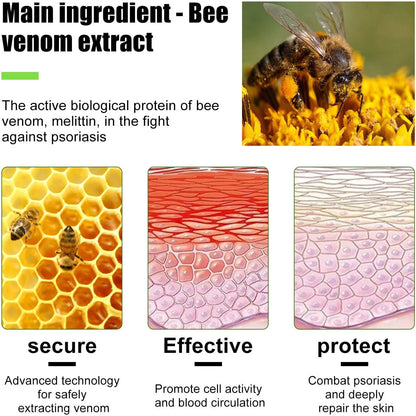 Todahof Bienengift-Psoriasis-Behandlungscreme, Todahof Bienengift-Psoriasis-Behandlungscreme, Todahof Bienengift-Creme, Psoriasis-Creme, Bienengift-Psoriasis-Behandlungscreme (3 Stück)