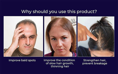 🌿AKTION ZUM LETZTEN TAG – 50 % RABATT🌿 HZA™ Natürliches Haarwuchsspray