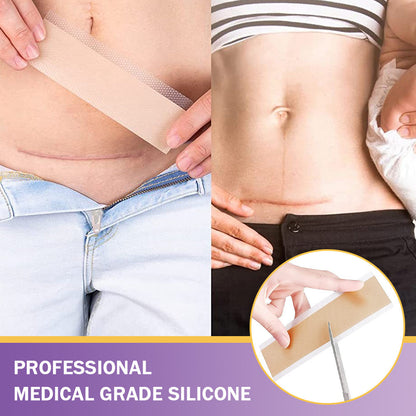 ✅Official Store |BBOJI® Hyaluronic Acid Nano Microneedle Repair Tape🏥(Treatment of old and new scars, reduction of surgical scars, stretch marks, keloids, acne, burns, warts, dermatomes and varicose veins)