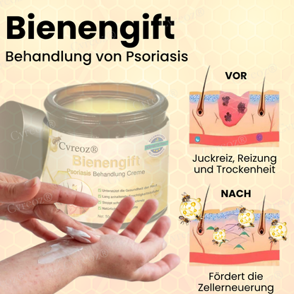 Cvreoz® Bienengift Psoriasis Behandlung Creme
