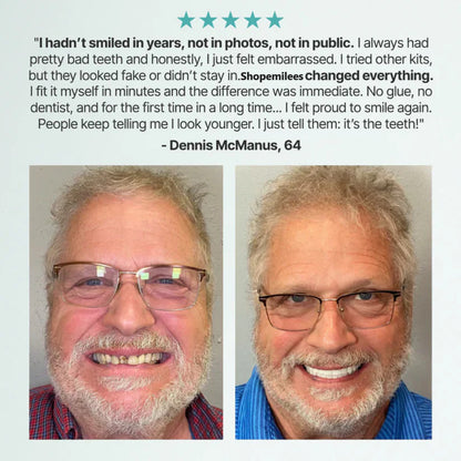 🌎Ends Today: 70% OFF! ⏰Shopemilees™ Medical Full Denture with Strong Suctiond🦷Obtain American Dental Association (ADA) Certification