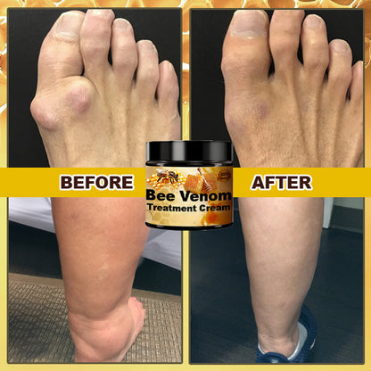 Bienengift-Creme zur Behandlung von Arthritis