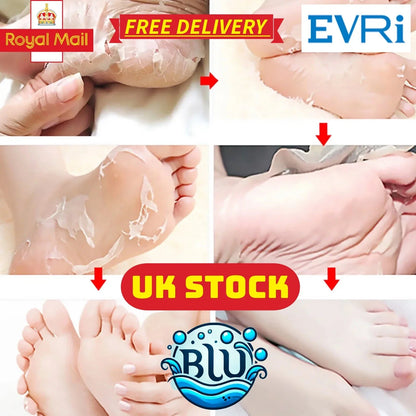 Natürliche Honig+VitE Fußpflege, Tötet Fußpilz ab, entfernt abgestorbene Hautzellen und macht die Füße so weich wie Babyfüße