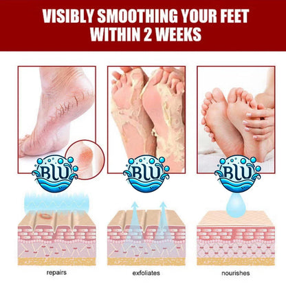 Natürliche Honig+VitE Fußpflege, Tötet Fußpilz ab, entfernt abgestorbene Hautzellen und macht die Füße so weich wie Babyfüße